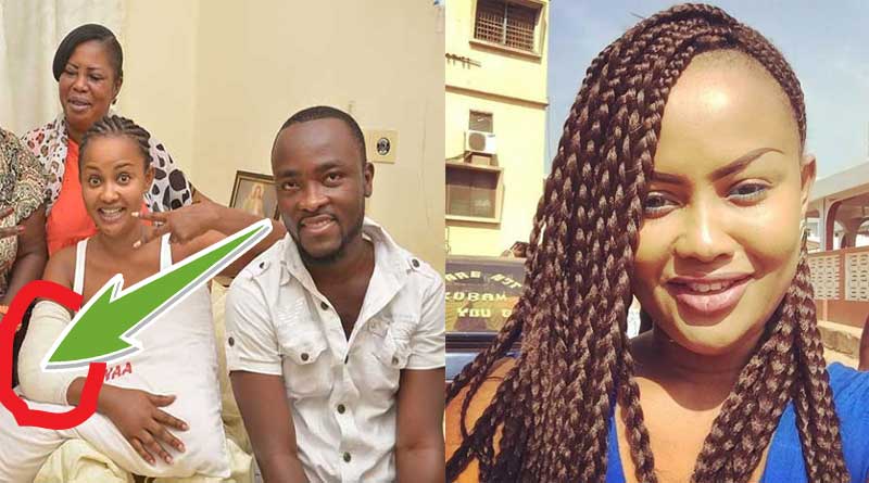 Nana Ama McBrown accident hand surgery Maxwell Praye Tiatia.