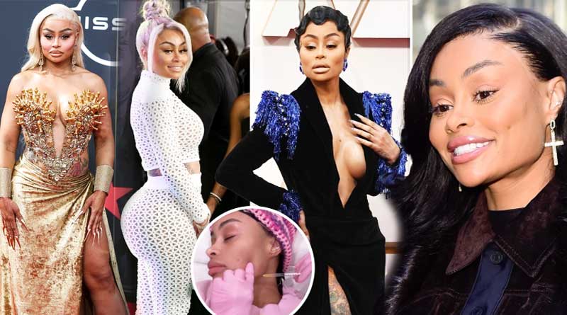 Blac Chyna says plastic surgery was the golden ticket to fame